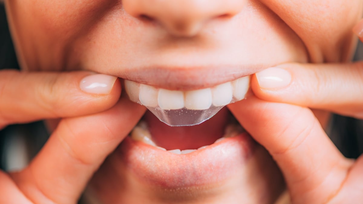 Woman smiling showing teeth with purple whitening strips product package displayed, featuring 30-minute whitening technology